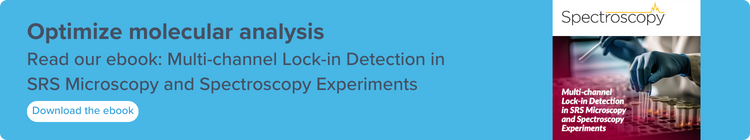 Read our ebook: Multi-channel lock-in detection in SRS microscopy and spectroscopy experiments