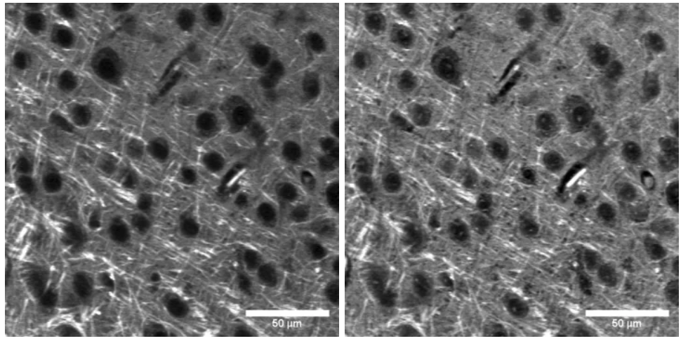 Lock-in amplifier images conducting Stimulated Raman spectroscopy (SRS) with images of brain samples